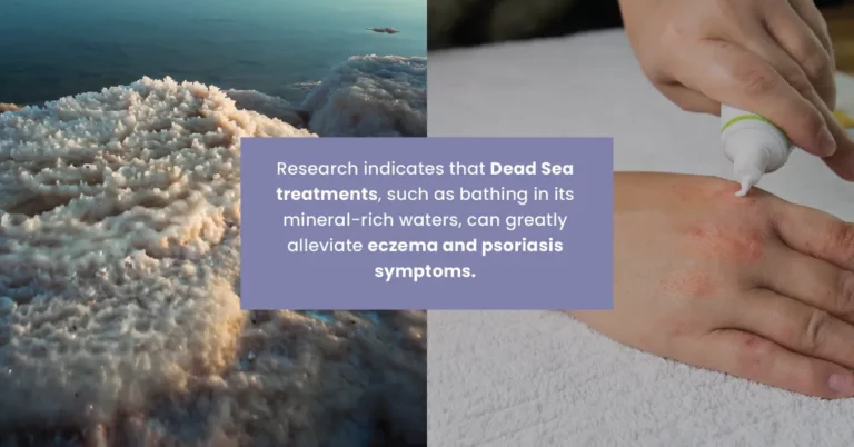 How Dead Sea Minerals Help Manage Eczema and Psoriasis Naturally